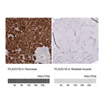 Atlas Antibodies Anti-PLA2G1B Antibody