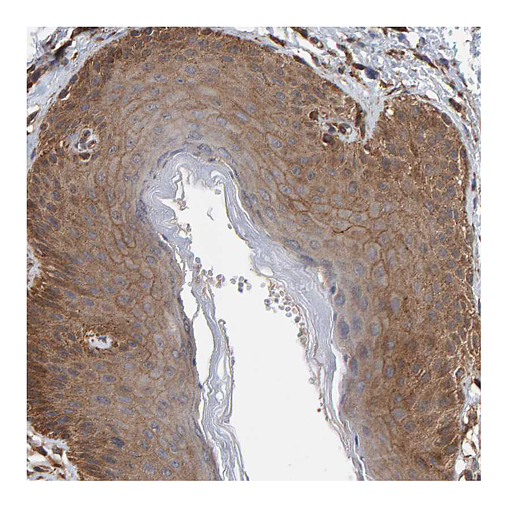 Atlas Antibodies Anti-PLA2G3 Antibody