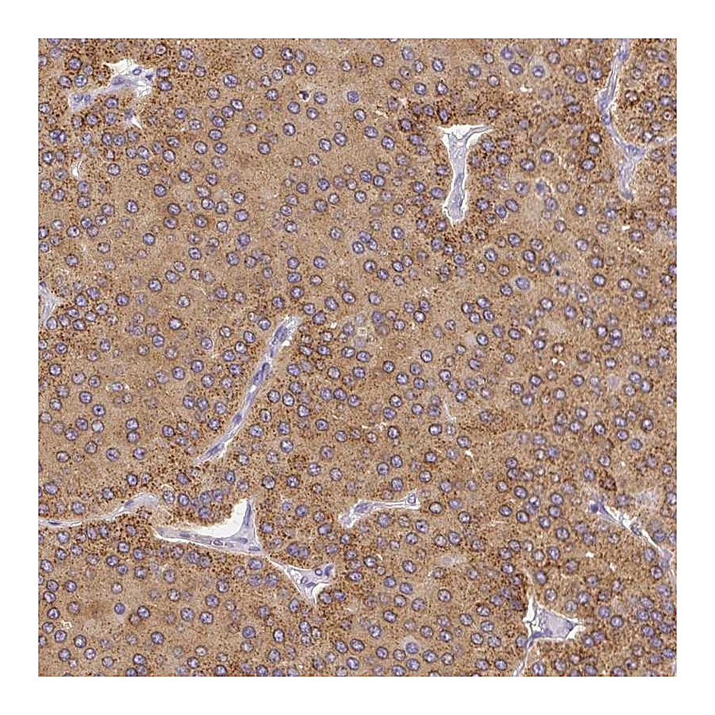 Atlas Antibodies Anti-PLA2G4A Antibody