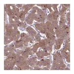 Atlas Antibodies Anti-PLA2G4A Antibody