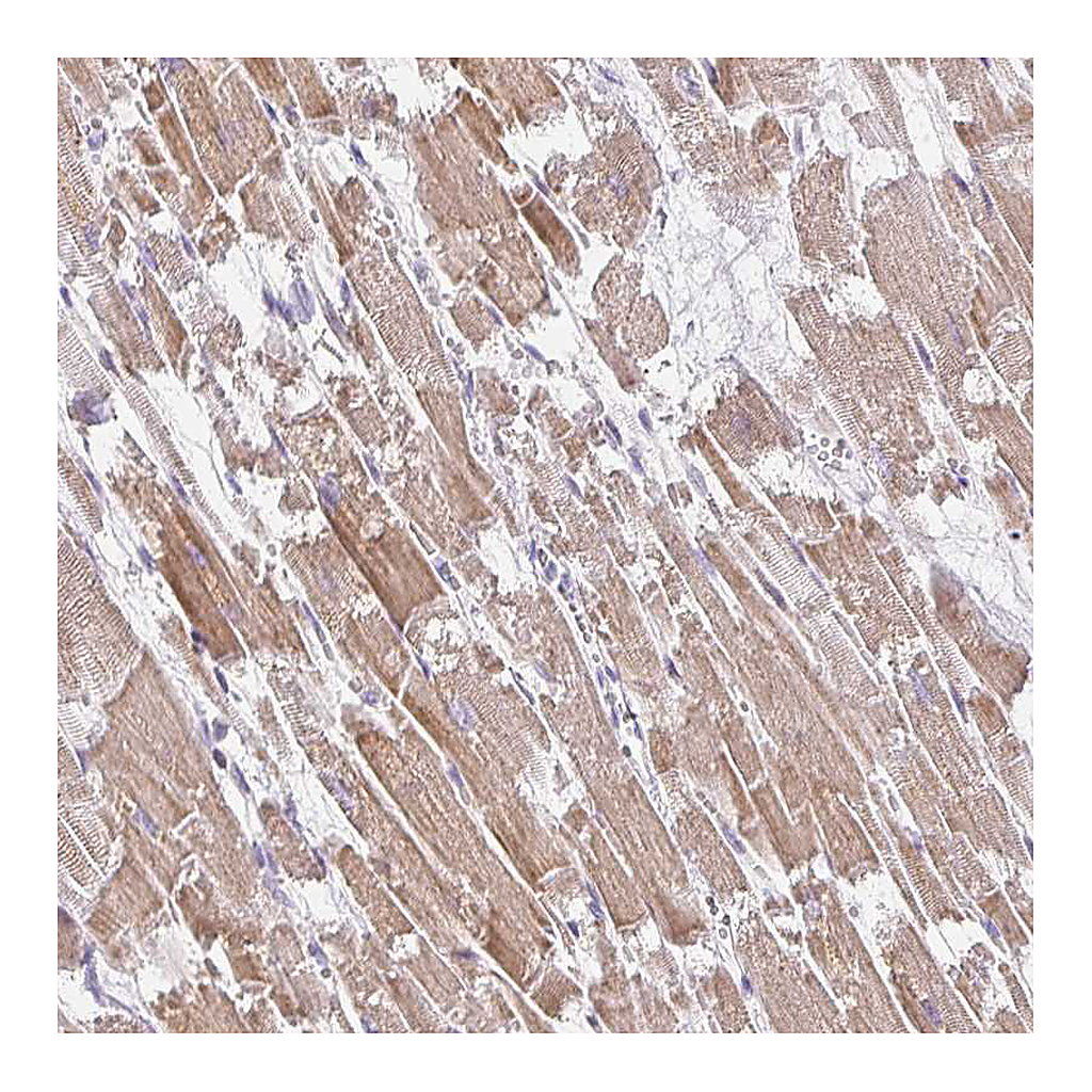 Atlas Antibodies Anti-PLA2G5 Antibody
