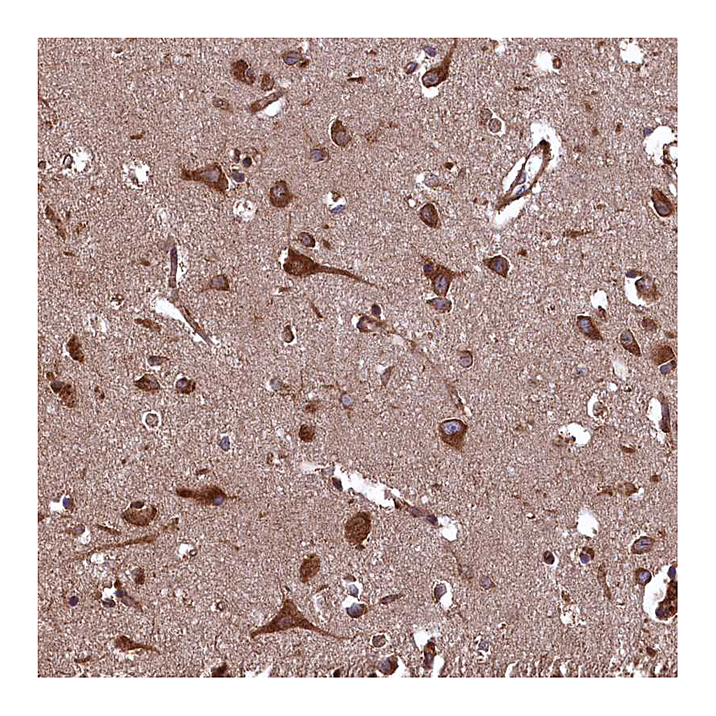 Atlas Antibodies Anti-PLA2G4C Antibody