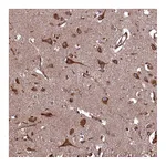 Atlas Antibodies Anti-PLA2G4C Antibody
