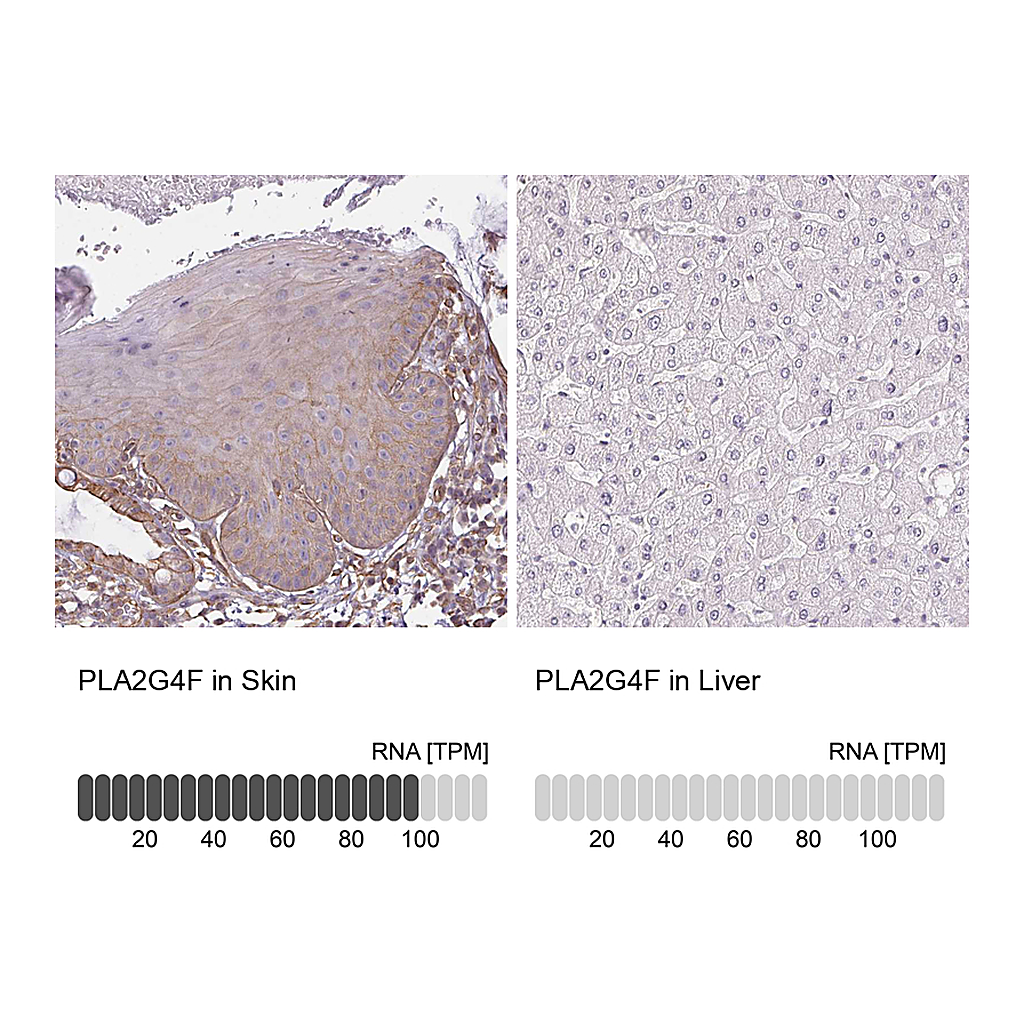Atlas Antibodies Anti-PLA2G4F Antibody