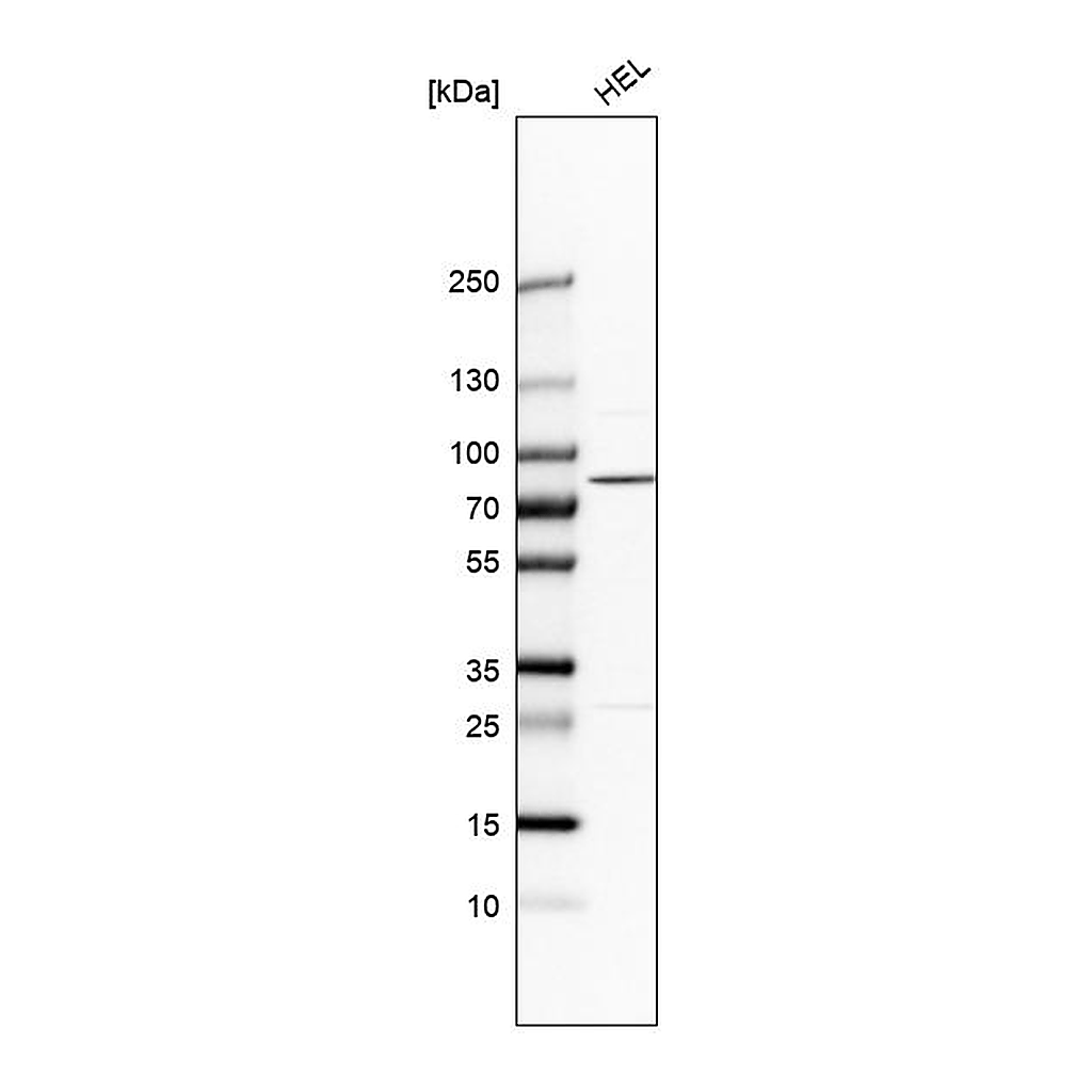 Atlas Antibodies Anti-PLA2G6 Antibody