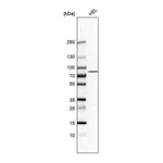 Atlas Antibodies Anti-PLA2G6 Antibody