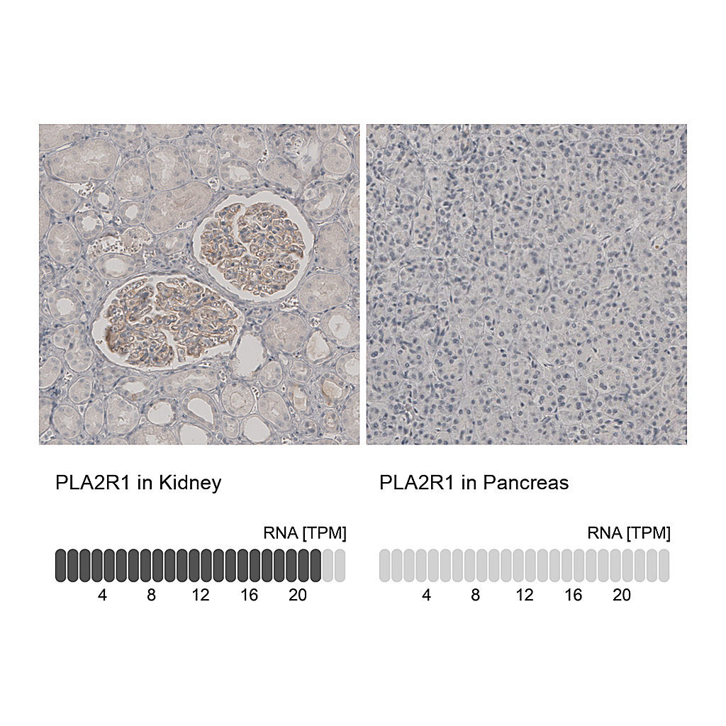 Atlas Antibodies Anti-PLA2R1 Antibody