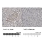 Atlas Antibodies Anti-PLA2R1 Antibody