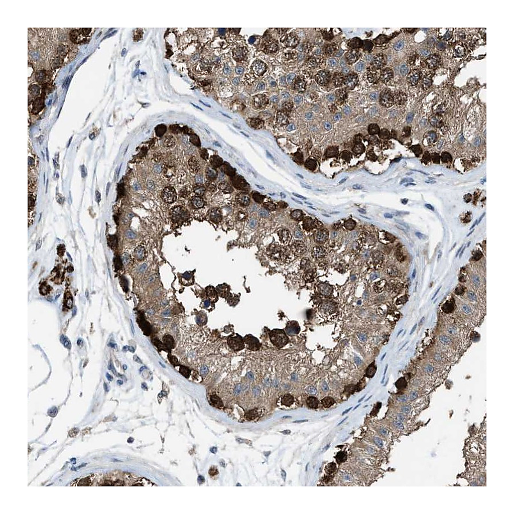 Atlas Antibodies Anti-PLAA Antibody