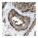 Atlas Antibodies Anti-PLAA Antibody