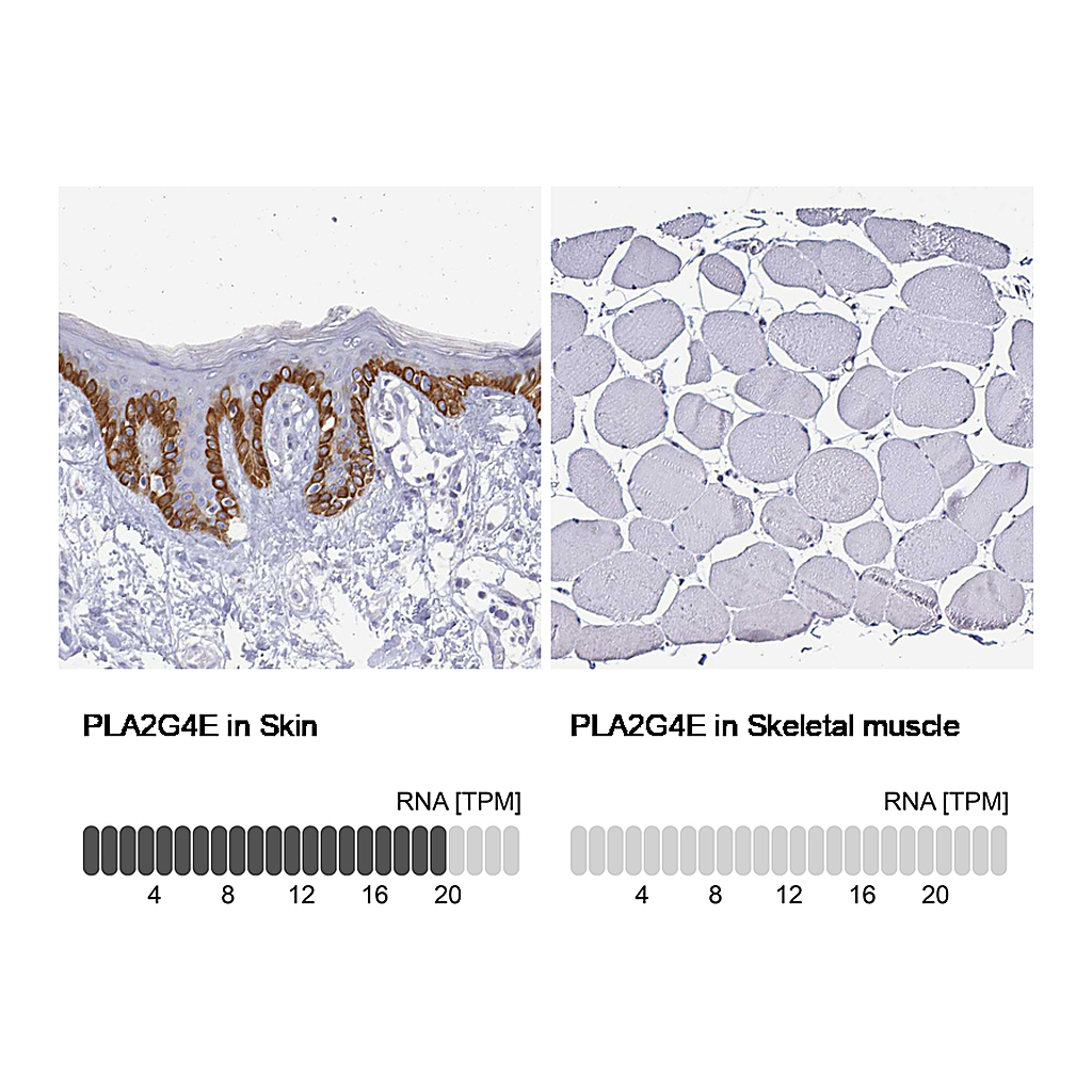 Atlas Antibodies Anti-PLA2G4E Antibody