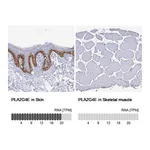 Atlas Antibodies Anti-PLA2G4E Antibody