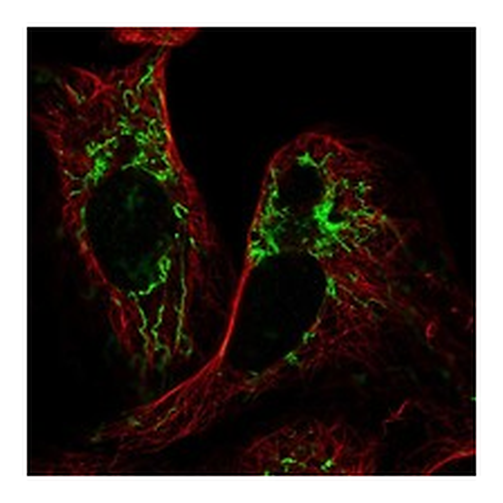 Atlas Antibodies Anti-PLAAT3 Antibody
