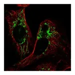 Atlas Antibodies Anti-PLAAT3 Antibody
