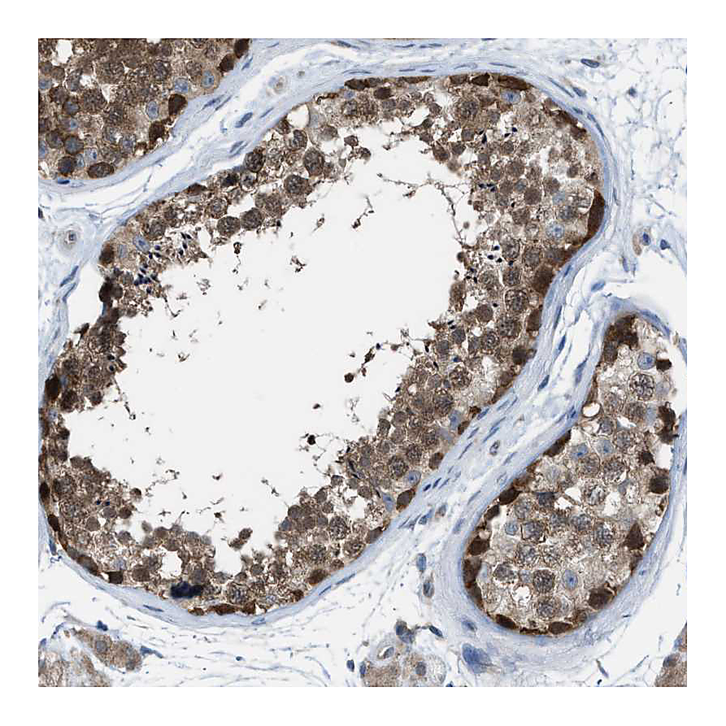 Atlas Antibodies Anti-PLAA Antibody