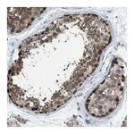 Atlas Antibodies Anti-PLAA Antibody