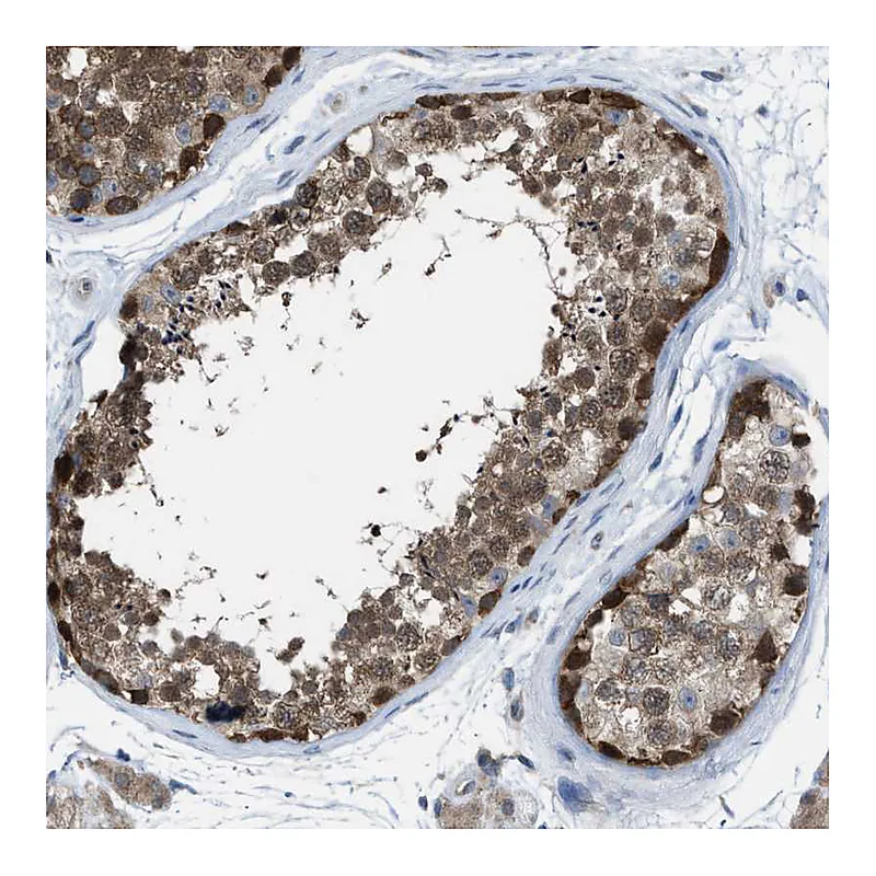 Atlas Antibodies Anti-PLAA Antibody
