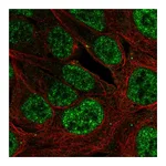 Atlas Antibodies Anti-PLAG1 Antibody