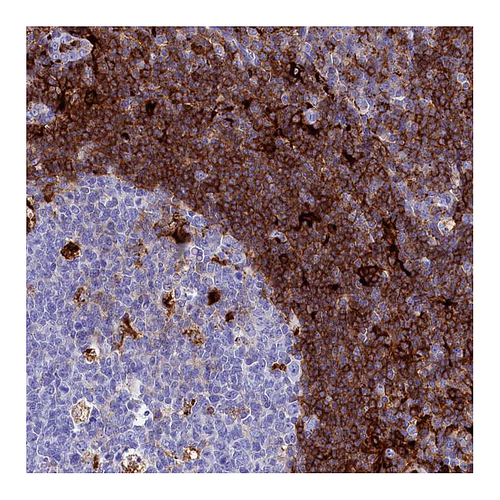 Atlas Antibodies Anti-PLAC8 Antibody