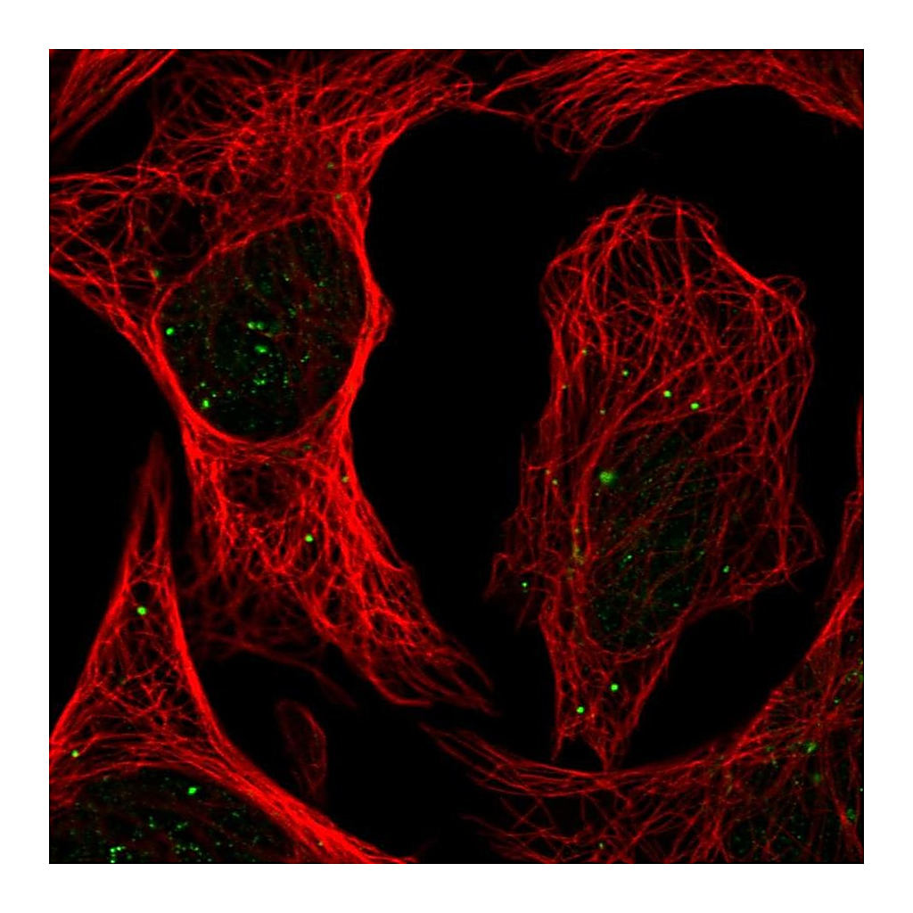 Atlas Antibodies Anti-PLAGL1 Antibody