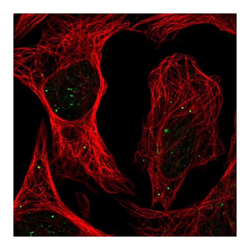 Atlas Antibodies Anti-PLAGL1 Antibody