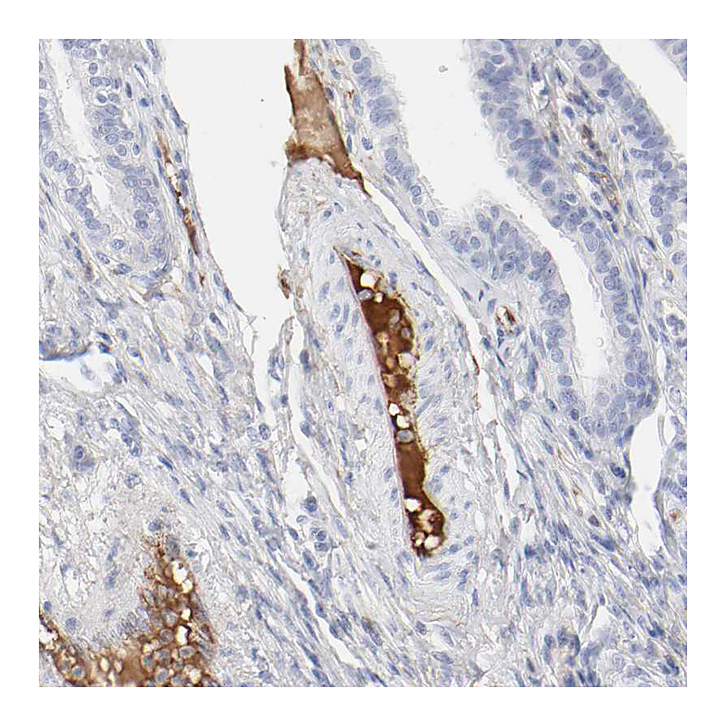 Atlas Antibodies Anti-PLAT Antibody