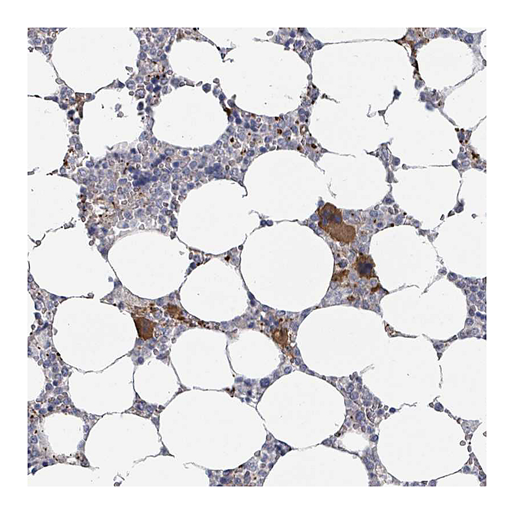 Atlas Antibodies Anti-PLAUR Antibody