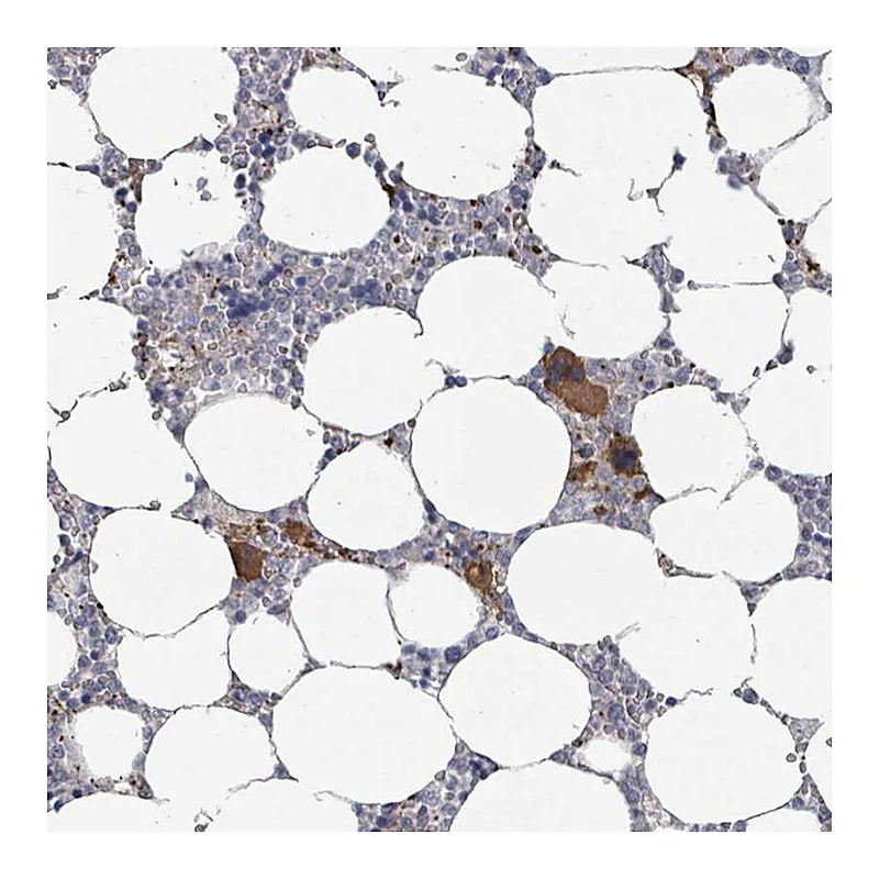 Atlas Antibodies Anti-PLAUR Antibody