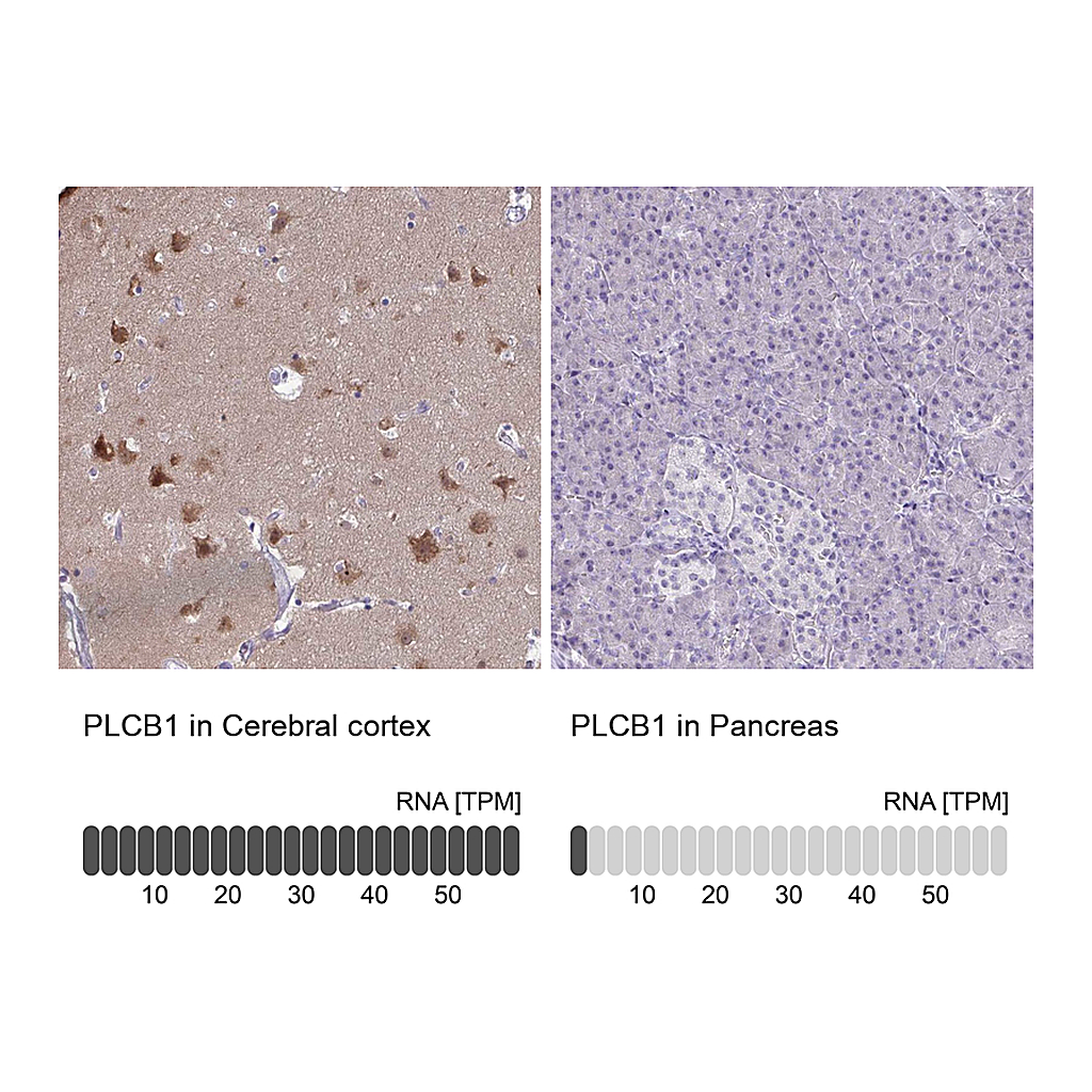 Atlas Antibodies Anti-PLCB1 Antibody