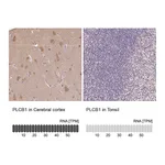 Atlas Antibodies Anti-PLCB1 Antibody