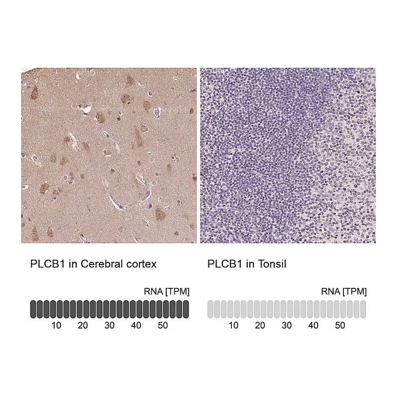 Atlas Antibodies Anti-PLCB1 Antibody