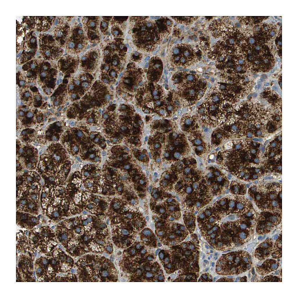 Atlas Antibodies Anti-PLBD2 Antibody