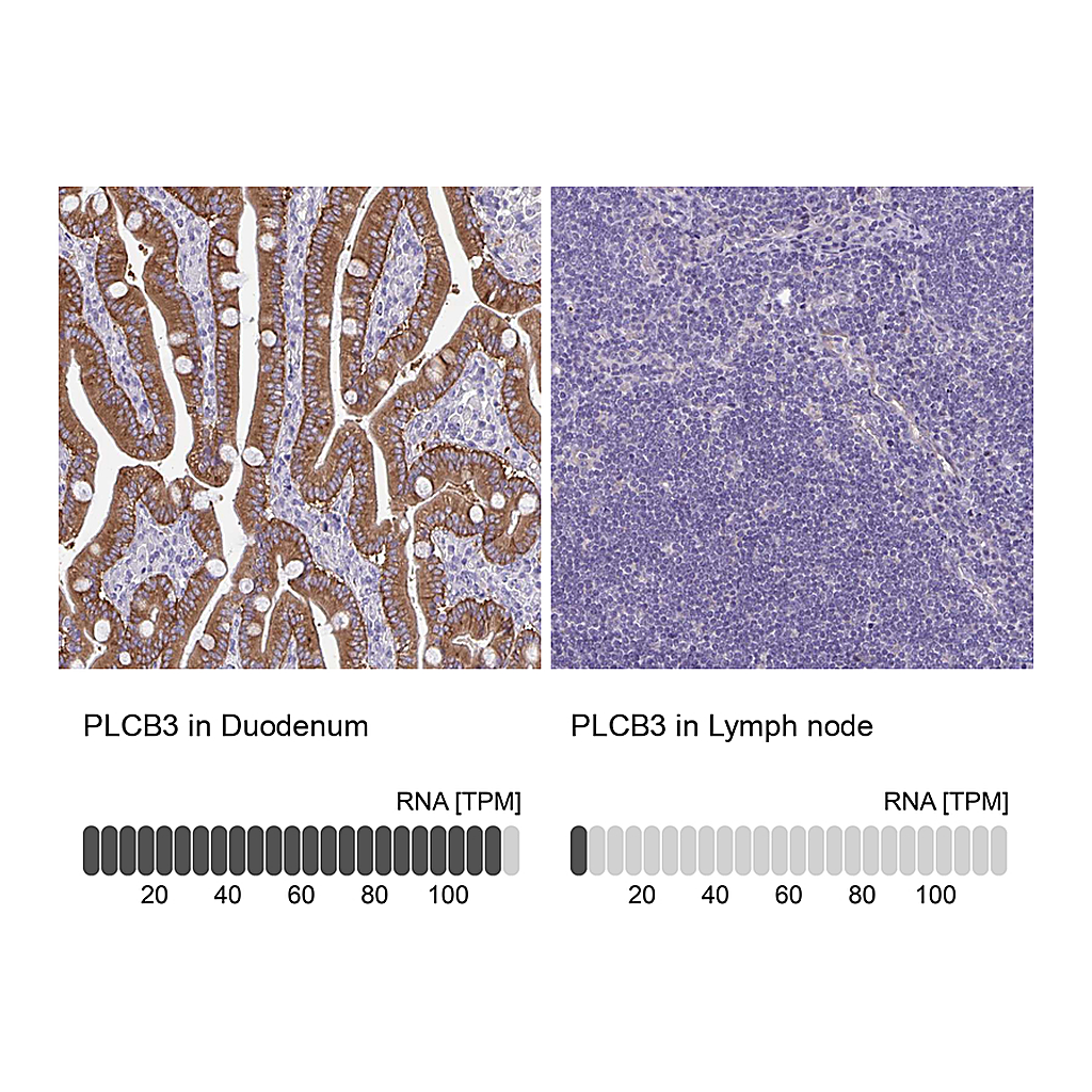Atlas Antibodies Anti-PLCB3 Antibody