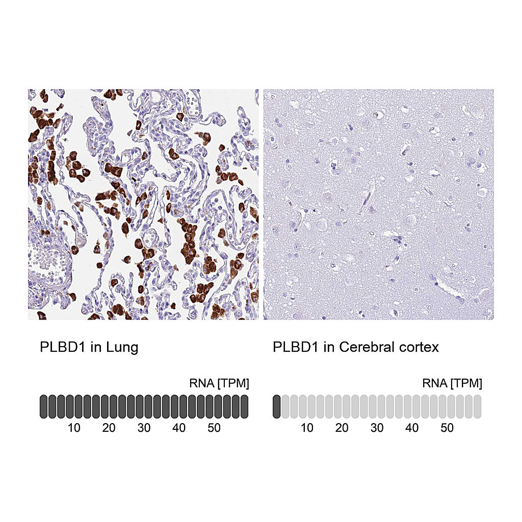 Atlas Antibodies Anti-PLBD1 Antibody