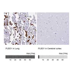 Atlas Antibodies Anti-PLBD1 Antibody