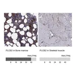 Atlas Antibodies Anti-PLCB2 Antibody