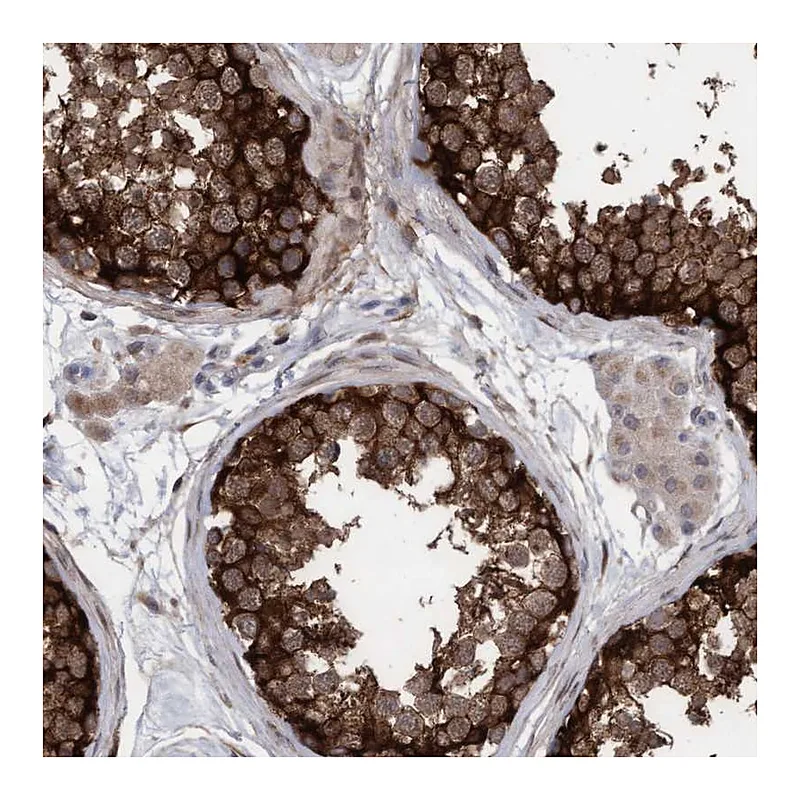 Atlas Antibodies Anti-PLCD1 Antibody