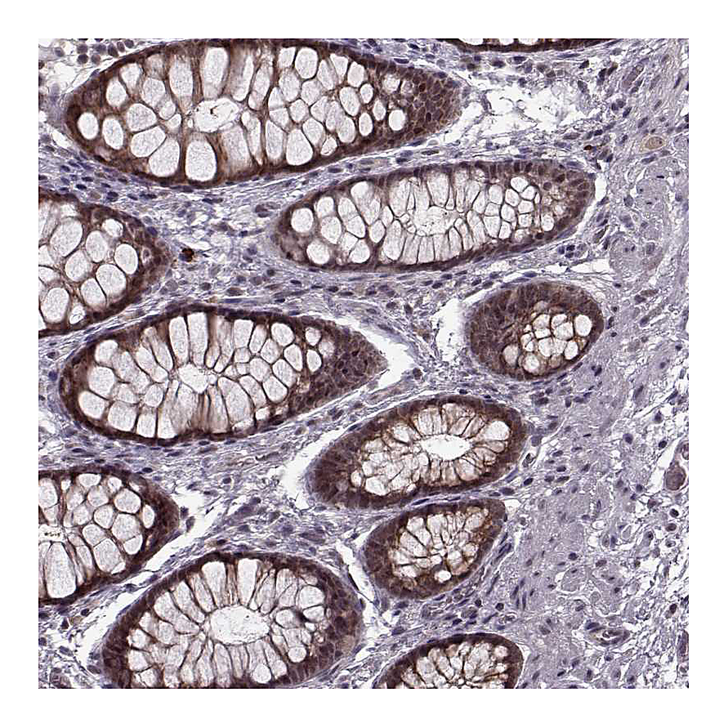 Atlas Antibodies Anti-PLCB4 Antibody