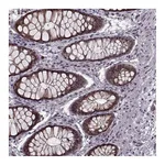 Atlas Antibodies Anti-PLCB4 Antibody