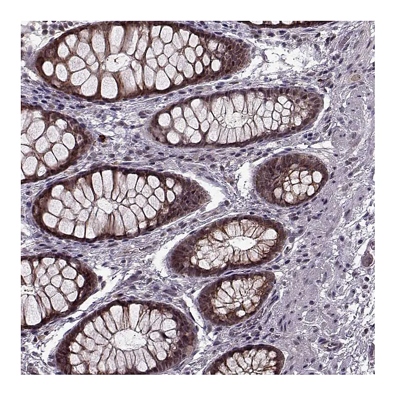 Atlas Antibodies Anti-PLCB4 Antibody
