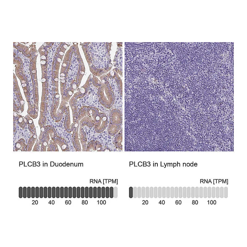 Atlas Antibodies Anti-PLCB3 Antibody