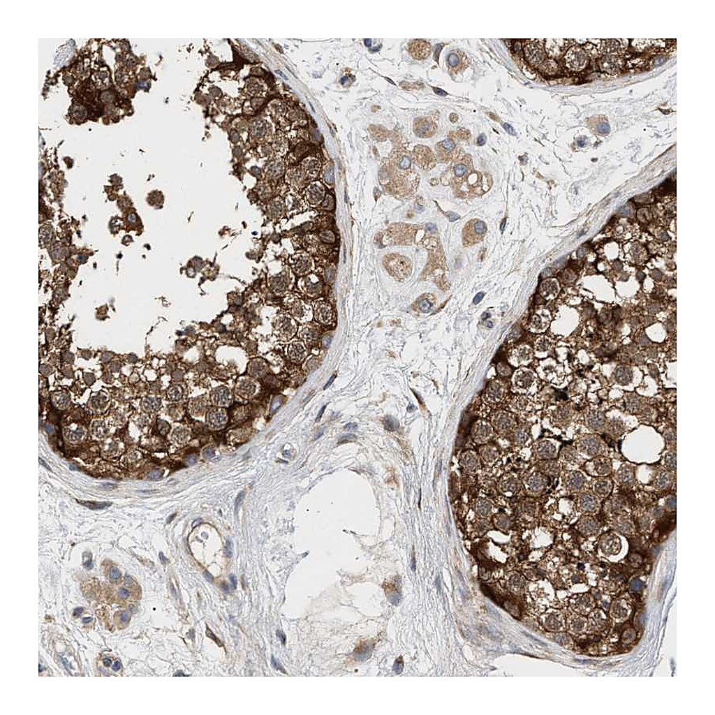 Atlas Antibodies Anti-PLCD1 Antibody