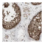Atlas Antibodies Anti-PLCD1 Antibody