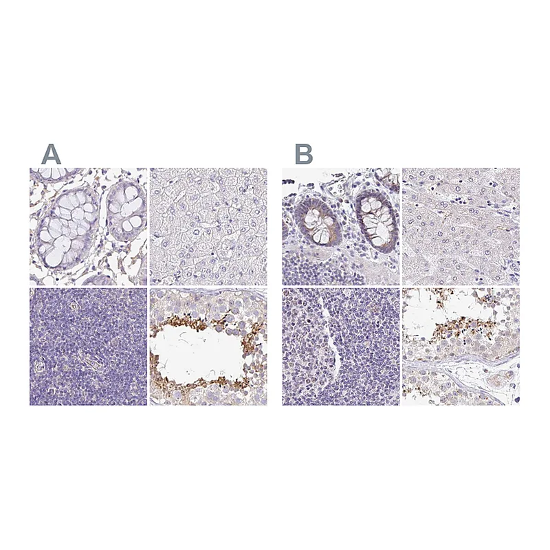 Atlas Antibodies Anti-PLCD4 Antibody