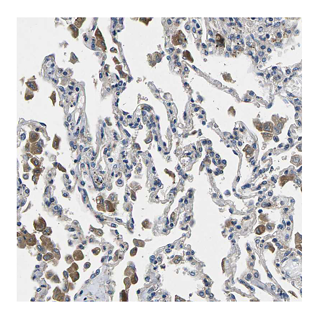 Atlas Antibodies Anti-PLCE1 Antibody