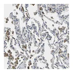Atlas Antibodies Anti-PLCE1 Antibody