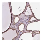 Atlas Antibodies Anti-PLCG1 Antibody