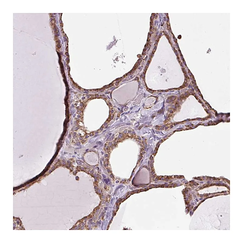 Atlas Antibodies Anti-PLCG1 Antibody