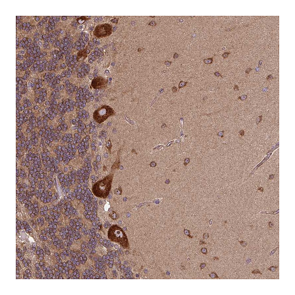 Atlas Antibodies Anti-PLCG1 Antibody