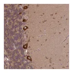 Atlas Antibodies Anti-PLCG1 Antibody